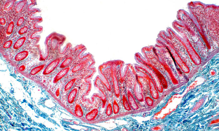 Gut under microscope